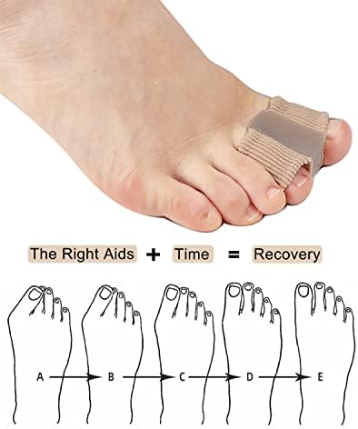 Golbylicc Bunion Toe Separators for Overlapping Toes Women Men, Gel Toe Spacers Bunion Corrector with 2 Loops for feet, Hammer Toe Straightener (2PC)