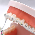 RZJZGZ Clear Dental Orthodontic Elastic Chain Power Chains Brace Orthodontic Spool Elastic Rubber Band (Long)