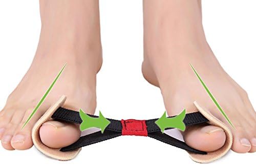 Big Toe Strap Bunion Straightener Stretchy Belt Toe Stretcher Alignment Hallux Valgus Corrector Foot Pain Relief