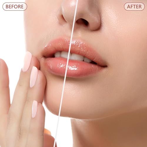 Facial Hair Remover for Women - as Seen on TV Painless Face Shaver - Electric Hair Removal Device for Face Lips Peach Fuzz with Light (Blue)