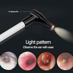 Slimline Stainless Pocket Otoscope, Handheld Ear Scope Otoscope with Soft LED Light & 7 Specula Tips for Kids Adults Pets Animals