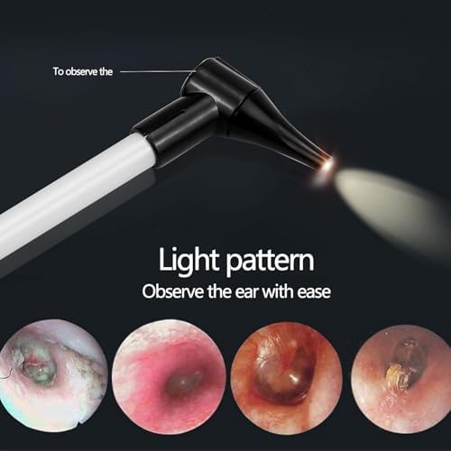 Slimline Stainless Pocket Otoscope, Handheld Ear Scope Otoscope with Soft LED Light & 7 Specula Tips for Kids Adults Pets Animals