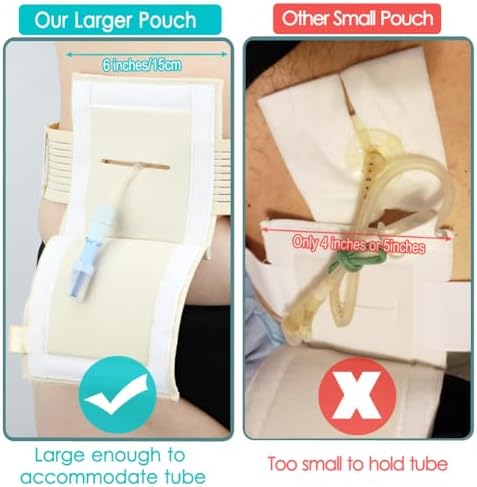 [2 Pack] Feeding Tube Belt, PEG Tube Holder G-Tube Protective Belt Breathable Beige with Slit for G Tube J Tube PEG Tube Supplies, No More Taping The Tube