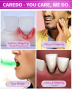 CAREDO Gum Toothpaste for Periodontitis, Gum Repair for Receding Gums, Gum Disease & Gingivitis Treatment, Periodontal Disease Treatment for Gum Health, Gum Disease Repair Bad Breath Toothpaste 3.52OZ