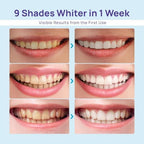 Whitebite Pro Teeth Whitening Kit for Sensitive Teeth – 32X LED Light + 35% Carbamide Peroxide Gel + Remineralizing Gel | Dental-Grade Whitening at Home Flavor Mint