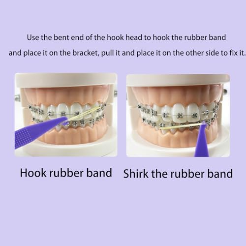 100PCS Elastic Rubber Bands Placers Tool for Braces,Colorful Disposable Plastic Orthodontic Elastic Placers Braces Rubber Band Tool
