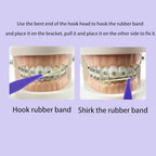 100PCS Elastic Rubber Bands Placers Tool for Braces,Colorful Disposable Plastic Orthodontic Elastic Placers Braces Rubber Band Tool
