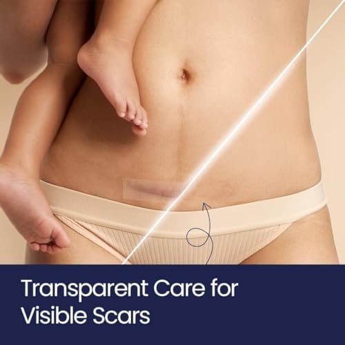 Silicone Scar Patches | Medical-Grade & Hypoallergenic Scar Care for Surgery, C Section Recovery, Keloids, Burns & Stretch Marks | 18 Pre-Cut Flexible Acne Scar Strips