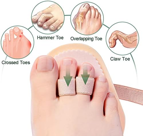 Welnove - Hammer Toes Straightener Toe Splint Corrector for Claw, Curled, Crooked Toe, Cushion Brace Joint Realign Metatarsal Support Loop Pack of 2 (2 Holes)