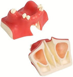 Dental Tooth Model Teeth Typodonts Dental Implant Maxillary Sinus Model Lift Practice Model for Training Teaching Demo and Study