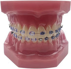 Orthodontic Dental Model with Brackets, YOUYA DENTAL Demonstration Orthodontic Model for Educational, Teeth Demonstration Typodont Anatomic Teaching Tool with 1/2 Metal and 1/2 Ceramic Bracke