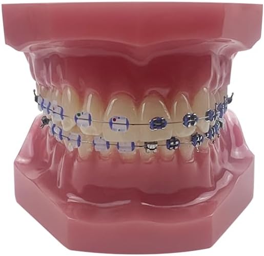 Orthodontic Dental Model with Brackets, YOUYA DENTAL Demonstration Orthodontic Model for Educational, Teeth Demonstration Typodont Anatomic Teaching Tool with 1/2 Metal and 1/2 Ceramic Bracke