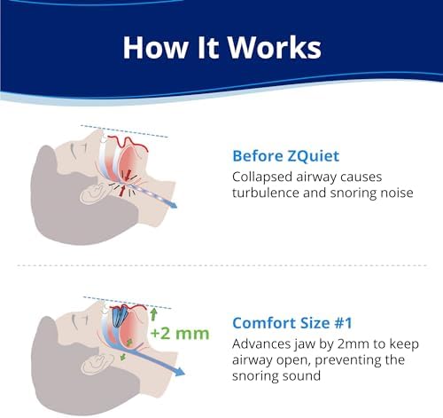 ZQuiet, Anti-Snoring Mouthpiece, Comfort Size #1, Single Refill, Clear, Made in USA, BPA-Free, Medical-Grade Material