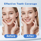 1 Pair Fake Dentures Teeth Covers for Men and Women Instant Dental Fix Easy to Use Snap-On Teeth Caps for Missing or Broken Temporary Smile Cover for Confidence and Comfort