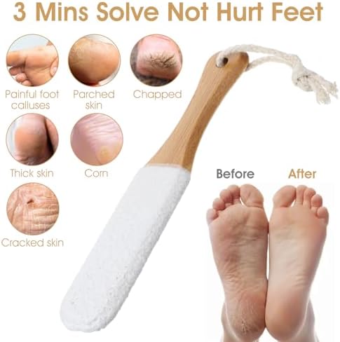 Foot Pumice Stone for Feet Callus Remover, Double Sided Foot Scrubber with Handle, Pedicure Foot File for Dead Skin, Heel Scraper Pumice Stone in Shower Corn Hard Skin Cracked Feet Care Tools