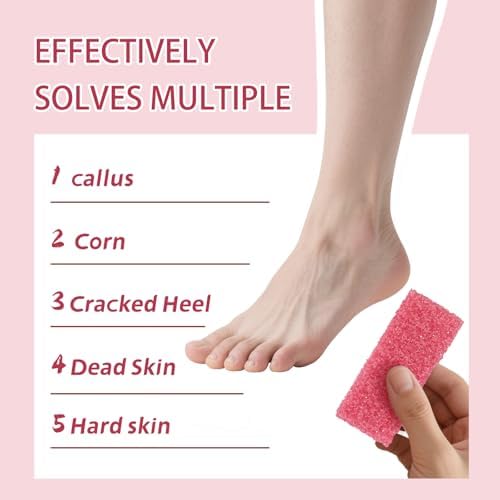 NOVAL Pumice Stone for Feet Scrubber Dead Skin Disposable Foot Pumice Foot Callus Remover Pedicure Tools Pink Pumice Sponge Nail Salon Home Use,40 PCS