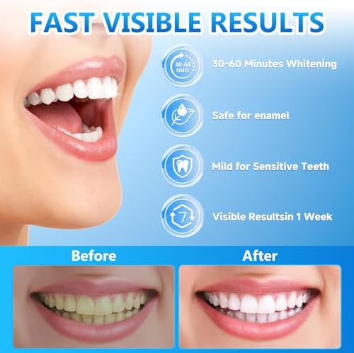 Milumber Teeth Whitening Strips for Sensitive, 42 Strips Whitener Safe Whitestrip, Deep Stains Removal Tooth Whitening, Enamel Safe Non-Slip Dry Strip Technology for Whiter Teeth, Mint