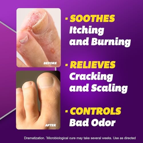 Silka Antifungal Cream, Clinical Anti-Fungus Foot Treatment, Results in 1 Week, Maximum Strength Athlete’s Foot Treatment, Jock Itch, Ringworm Treatment for Humans, Terbinafine Cream, 1oz- 2 Pack