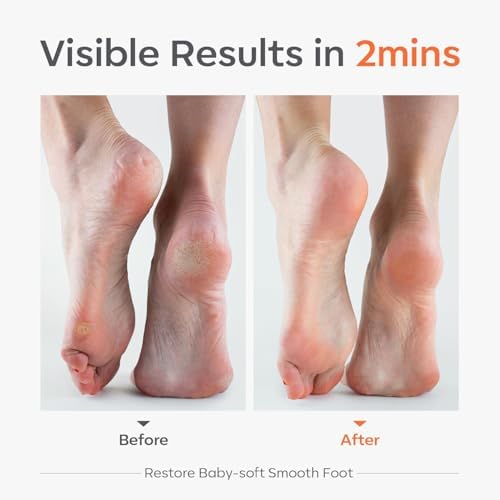 Nano Glass Foot File for Dead Skin and Callus Removal, Gentle Pedicure Tool & Foot Scrubber for Wet and Dry Feet, Portable Glass Exfoliator Heel File for Women and Men, Smooth Foot Care Tool