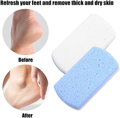 VOCOSTE 2 Pcs Foot Care Exfoliating Scrub Stone Double Sided Fine and Coarse Pumice Stone Foot File Blue White