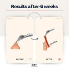GlanMax tool for phimosis | Phimosis Stretching tool | Opens upto 24mm | Safe & very quick results