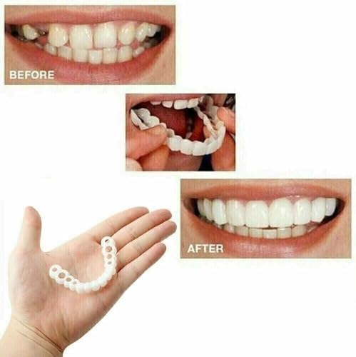 2 Pairs Adjustable Temporary Veneers for Men & Women, Natural Comfortable Design to Restore Confident Smile