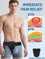 Hernia Belts for Men Inguinal, Hernia Belt for Women, Inguinal Hernia Support for Left or Right Side, Comfortable Adjustable Waist Strap with Removable Compression Pads