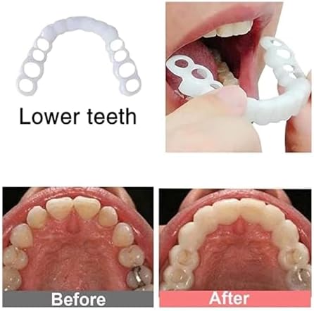 2 Pairs,Regain Confidence Smile,Adjustable for Men and Women,Temporarily Adjustable (1)