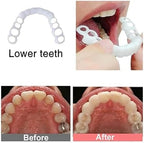 2 Pairs,Regain Confidence Smile,Adjustable for Men and Women,Temporarily Adjustable (1)