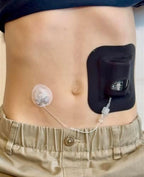 Glucomart Adhesive Pocket for Mobi (5 Count) – Maximum Strength Patches for Wearing Mobi Insulin Pump, Waterproof & Hypoallergenic (Solids Pack) (Mobi Pocket) (Black)