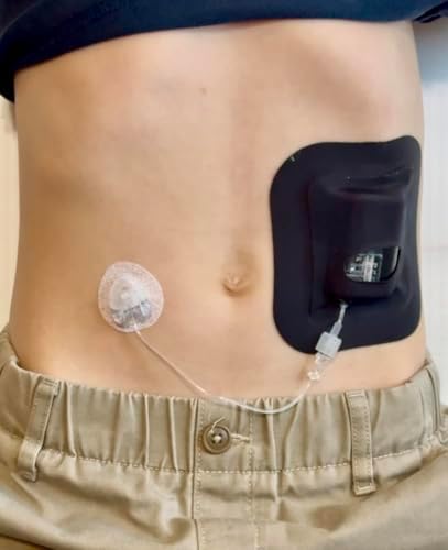 Glucomart Adhesive Pocket for Mobi (5 Count) – Maximum Strength Patches for Wearing Mobi Insulin Pump, Waterproof & Hypoallergenic (Solids Pack) (Mobi Pocket) (Black)