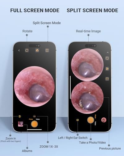 Digital Otoscope Compatible with iPhone and Android Devices, HD Ear Camera with Ear Wax Removal Tools, Video Ear Scope Otoscope with Light, Capture Photos and Videos (Silver)