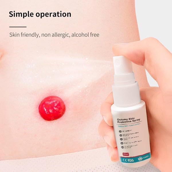 Ostomy Skin Barrier Spray - No Sting, Alcohol-Free for Sensitive Skin, Creates a Protective Seal Around Stomas & Wounds to Prevent Leaks, Secures Medical Devices, 1 fl oz (30mL)