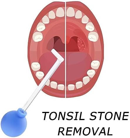 Tonsil Stone Remover, Manual Vacuum Tonsil Stone Removal Kit Tool, Dental Suction Mouth Cleaner Mouth Cleaning, Mouth Cleaner for Adults