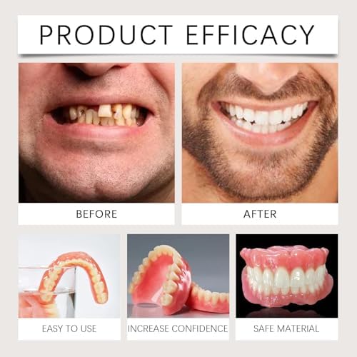 Silicone Full Denture Set, Moldable Dentures, Premium Dentures, Silicone Reline Denture Set, Denture Silicone Reline Kit (2)