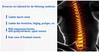 KEhtu Lumbar Decompression Device, Portable Hand-Operated Lumbar Traction Device, Lumbar Physiological Radian Design, Used for Home Treatment of Lumbar Disc Herniation