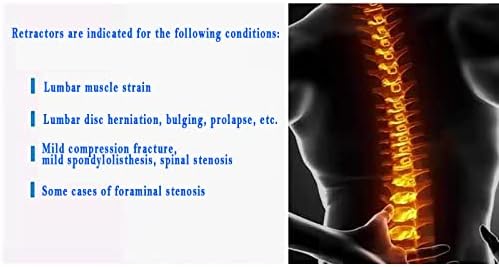 KEhtu Lumbar Decompression Device, Portable Hand-Operated Lumbar Traction Device, Lumbar Physiological Radian Design, Used for Home Treatment of Lumbar Disc Herniation