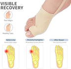 2PCS Bunion Corrector for Women & Men, Big Toe Straightener Splint | Hallux Valgus Pain Relief with Comfortable Pads & Splint,Day & Night Support, Breathable