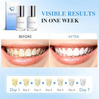 Tooth Polish, Tooth Whitening Paint, Cosmetic Teeth Polishing Liquid for Improving Teeth Appearance, Simple & Portable White Paint for Teeth - Regain Confident Smile