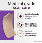 Mederma Medical Grade Silicone Scar Sheets - Improves Appearance of Old & New Scars from Injury, Burn & Surgery, Breathable & Flexible, 4 Count