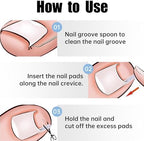 50 Pcs Ingrown Toenail Corrector Set, Toenail Correction Strips Brace Kit, Ingrown Toenails Correction Pad Recover Clips, Toenails Straightener Strips for Women Men's Nail Treatment Pedicure