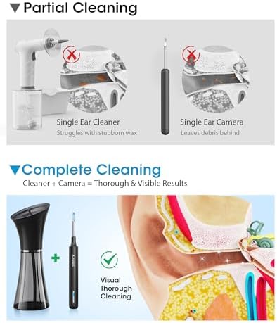 KAUGIC Ear Wax Removal Kit with Camera – Ear Cleaner Tool for Safe & Effective Ear Care – Includes Ear Camera for Visual Inspection & Gentle Ear Irrigation System – Complete Ear Cleaning Solution