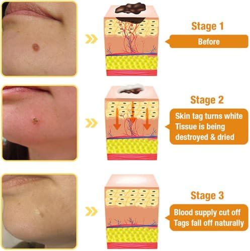 Bee Venom Skin Treatment Cream, 2024 New Bee Venom Repair Cream, Professional Bee Venom Cream-30g, Repair Maximum Strength for All Skin Types (1 Bottle)