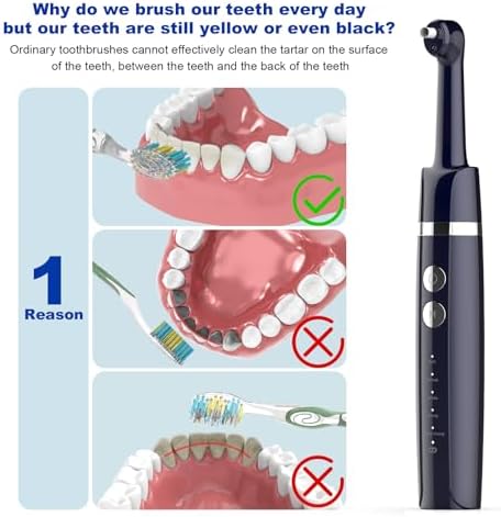 Tooth Polisher,Teeth Polishing Kit for Daily Cleaning,Polishing Then Whitening of Tooth (Professional Toothpaste Include),USB Rechargeable Dental Polisher with LED Light,6 Heads,5 Speed Modes