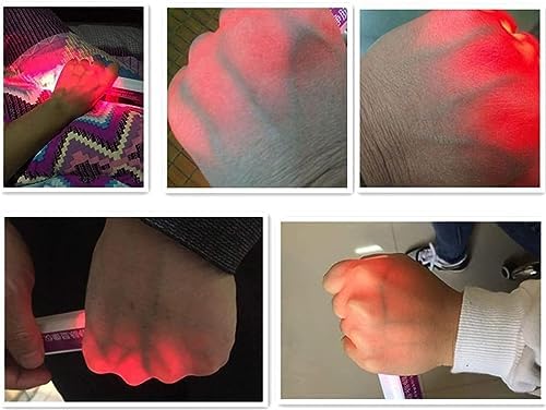 Pen Lights Portable Handheld Vein Viewer Rechargeable Vascular Display Device Viewer for The Elderly and Children to Easily Locate Subcutaneous Veins