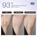 Ulike Laser Hair Removal Device Air 4 Ipl Gift for Women and Men, Ice Cool and Permanent Hair Reduction for Nearly Painless, USHR Mode Hair Removal in 10mins from Home