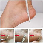 Professional Pedicure Kit - 2-Pack Stainless Steel Foot Files & Callus Removers - Dead Skin Scraper for Men & Women - Durable Foot Care Tools for Hard Skin Removal