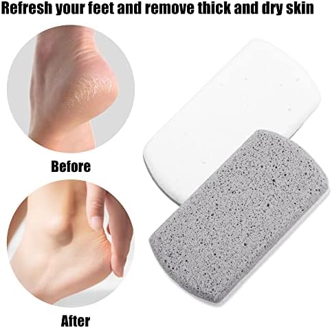 2 Pcs Foot Care Exfoliating Scrub Stone, Double Sided Fine and Coarse Pumice Stone, Foot File, Grey White