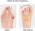Bunion Corrector, Adjustable Big Toe and Tail Toe Separator Orthopedic Bunion Splint Brace, Hammer Toes Straightener Bunions Relief, Breathable Bunion Socks Sleeves for Women Men, Day Night Support (L)