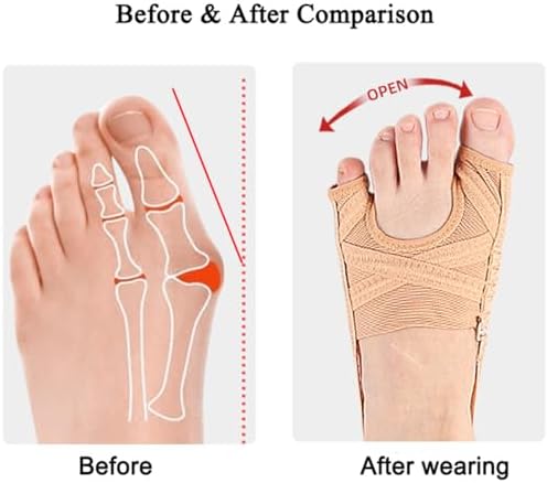 Bunion Corrector, Adjustable Big Toe and Tail Toe Separator Orthopedic Bunion Splint Brace, Hammer Toes Straightener Bunions Relief, Breathable Bunion Socks Sleeves for Women Men, Day Night Support (L)